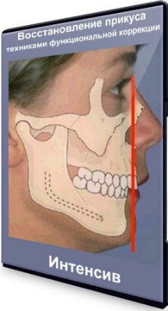 постер к Восстановление прикуса техниками функциональной коррекции (2020) Интенсив