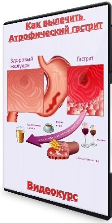 постер к Сергей Вялов - Как вылечить Атрофический гастрит (2022) Видеокурс